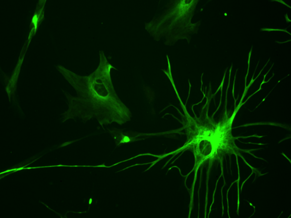 La bioelettronica green che ascolta e stimola le cellule del cervello